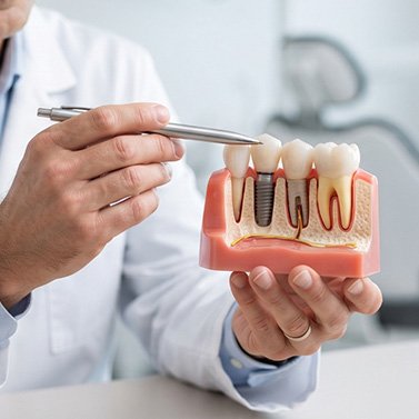 Hands of dentist holding model implant and pointing to it with silver pen