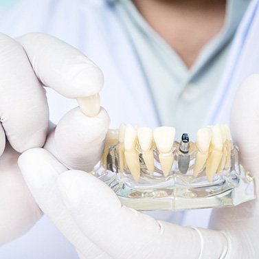 Gloved hands holding clear base with dental implant and a dental crown