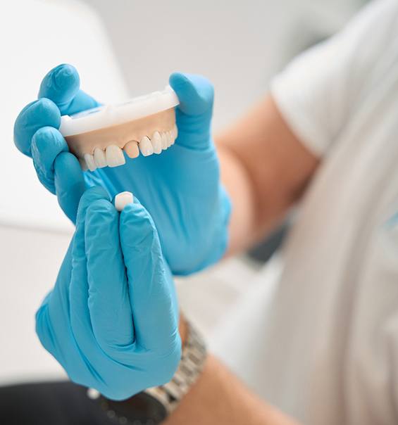 Hands holding sample dental crown close to model jaw with abutment tooth