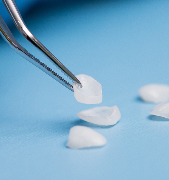 A closeup of a veneer being held by tweezers