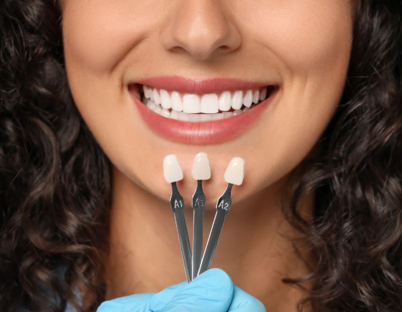 Woman holding veneers up to her smile